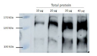 RPB2 | DNA-directed RNA polymerase II subunit 2 in the group Antibodies Plant/Algal / Global Antibodies at Agrisera AB (Antibodies for research) (AS20 4376)